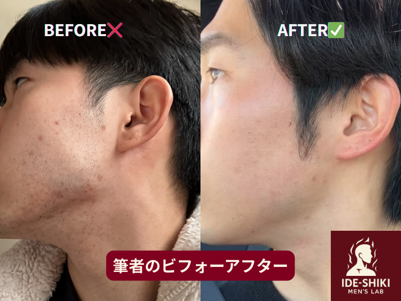 筆者自身のビフォーアフター画像