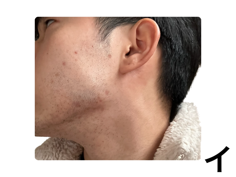 スキンケアを習慣にする前の肌。