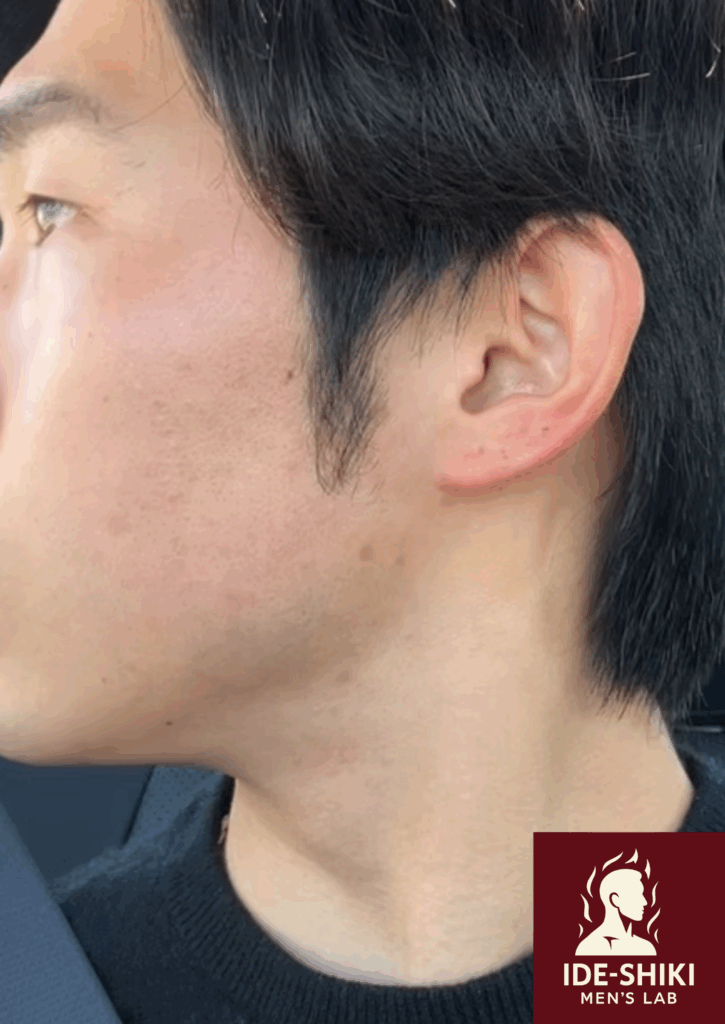 正しいスキンケアによって肌を生まれかわらせた筆者の現在の画像1
